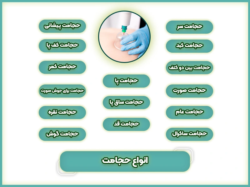 انواع حجامت