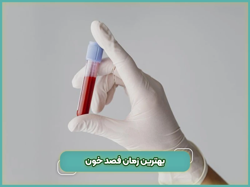 بهترین زمان فصد خون