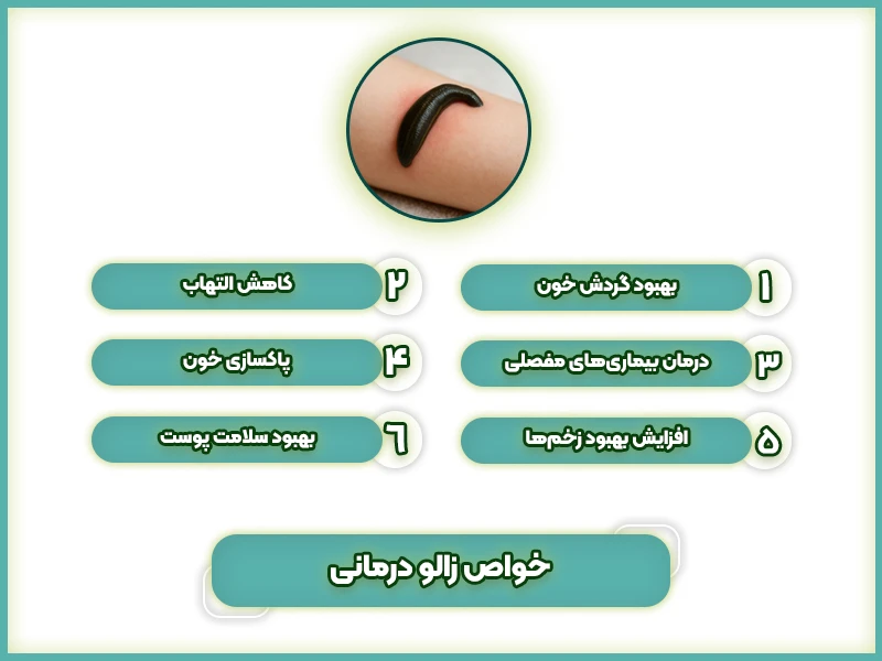 خواص زالو درمانی