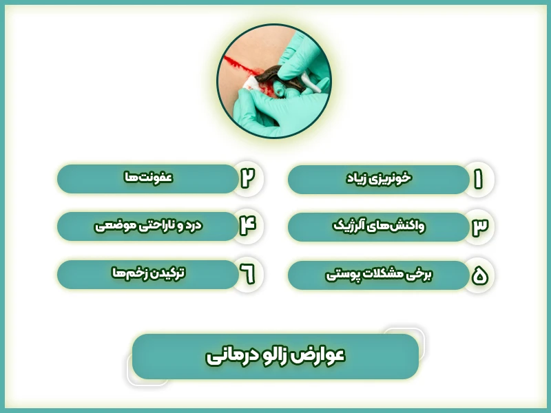 عوارض زالو درمانی