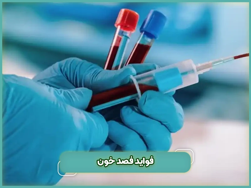 فواید فصد خون