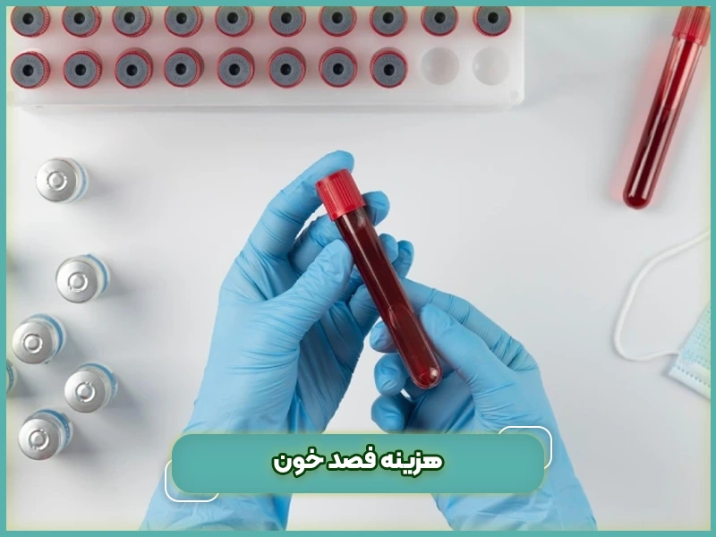 هزینه فصد خون