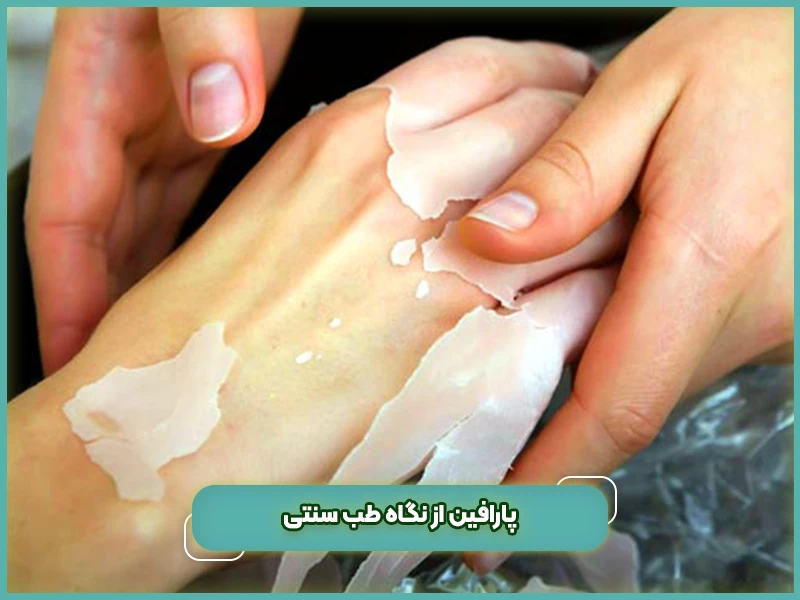 پارافین از نگاه طب سنتی