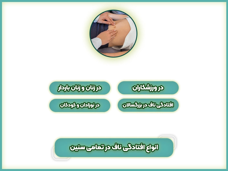 انواع افتادگی ناف در تمامی سنین