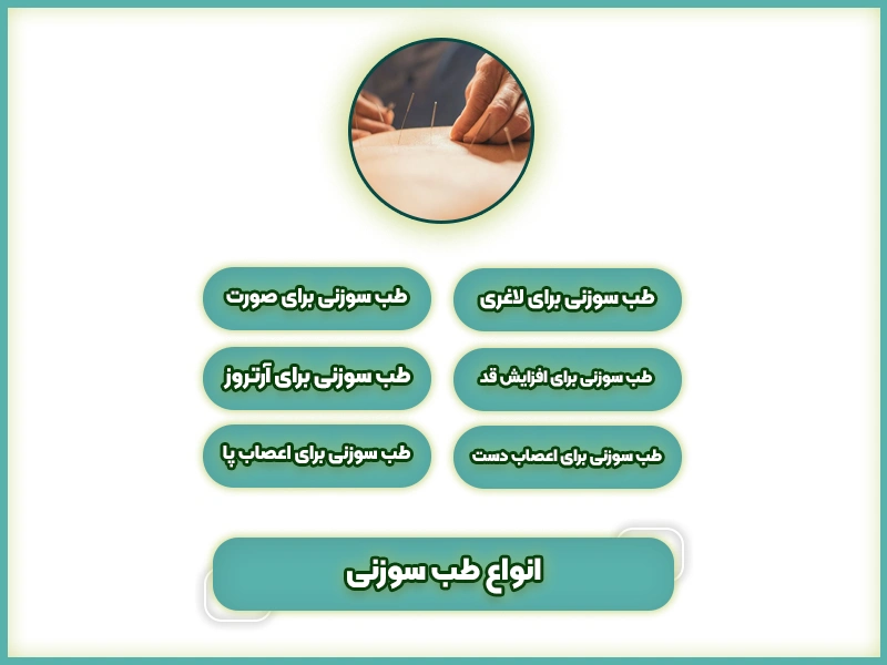 مرکز طب سوزنی | کلینیک طب سوزنی در تهران 28 انواع طب سوزنی