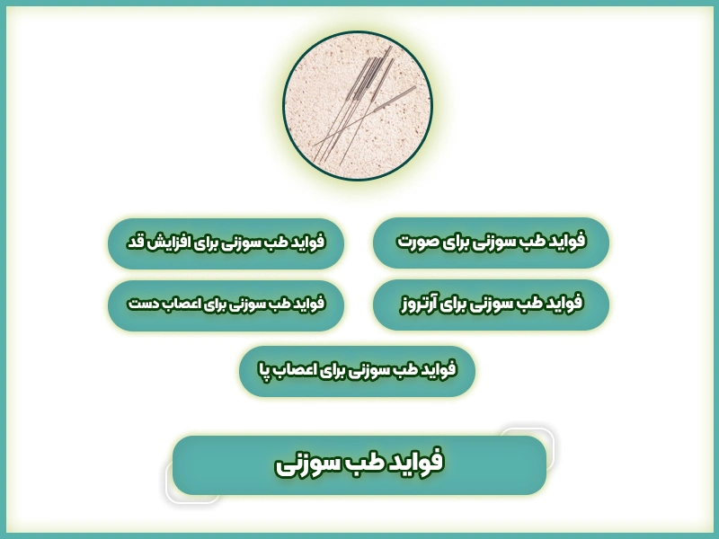 مرکز طب سوزنی | کلینیک طب سوزنی در تهران 30 فواید طب سوزنی