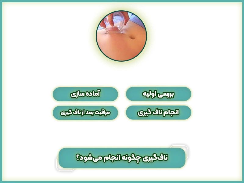 ناف‌گیری چگونه انجام می‌شود؟