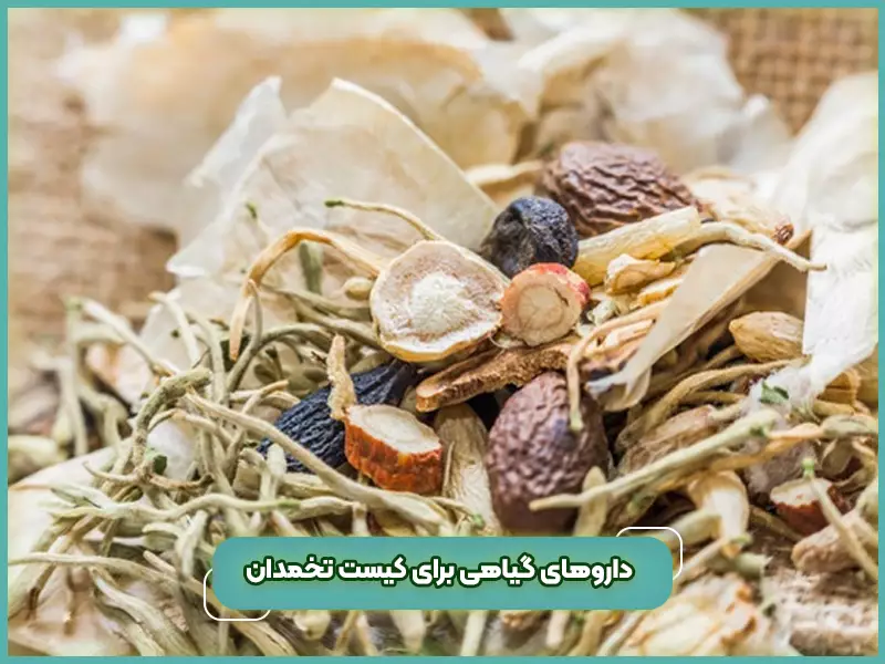 دارو‌های گیاهی برای کیست تخمدان