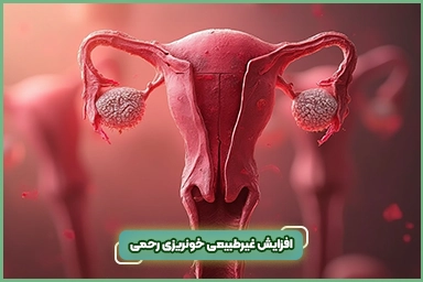 افزایش غیرطبیعی خونریزی رحم