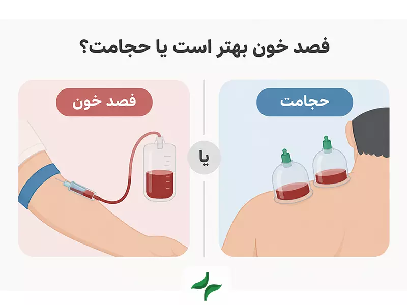 فصد خون بهتر است یا حجامت؟