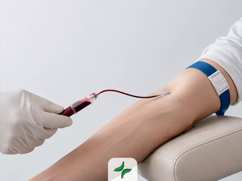 فصد خون چگونه انجام میشود؟