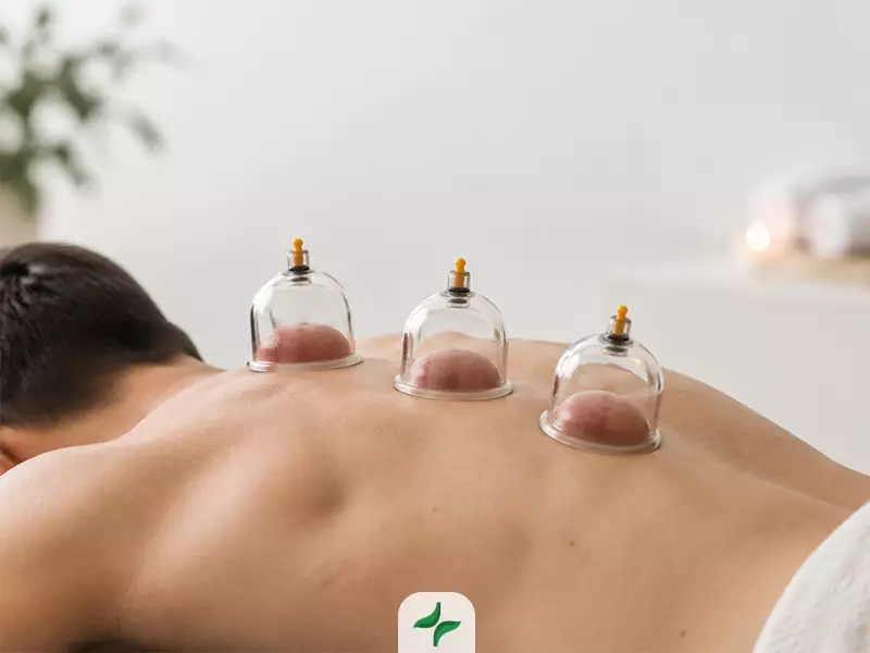 حجامت چیست و چگونه روی بدن تأثیر می‌گذارد؟